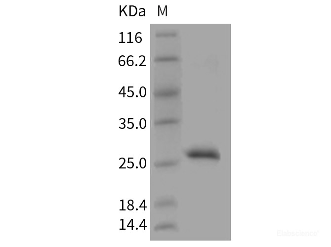 Recombinant Mouse RPE / RPE2-1 Protein (His tag)-Elabscience