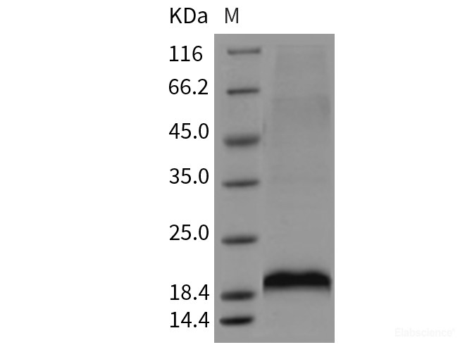 Recombinant Mouse MANF / ARMET Protein (His tag)-Elabscience