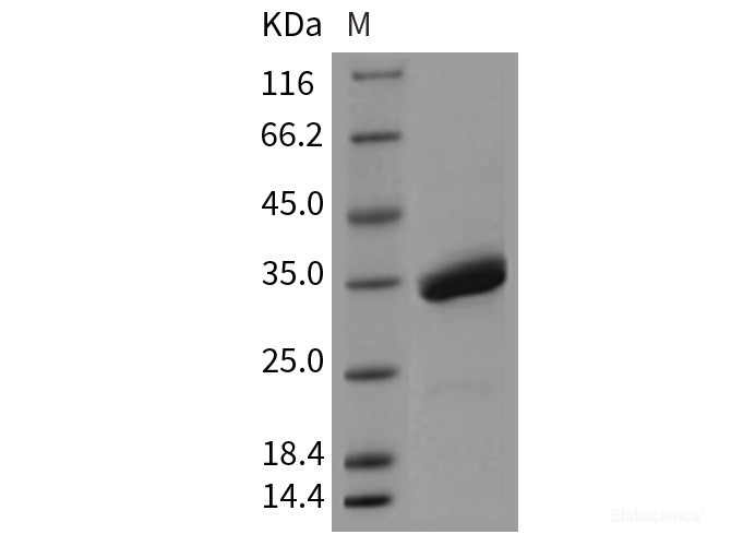 Recombinant Mouse SPINK4 Protein (Fc tag)-Elabscience