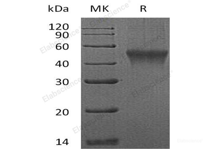 Recombinant Mouse  FCRL1 Protein (His Tag)-Elabscience
