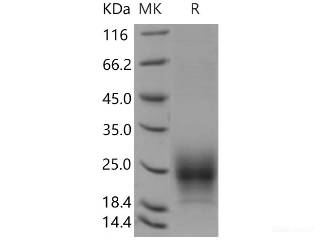 Recombinant Mouse  TIGIT Protein (His Tag)-Elabscience