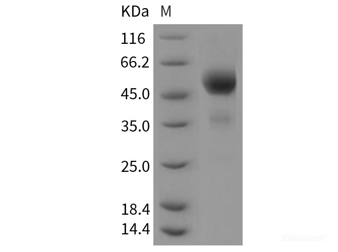 Recombinant Mouse TIGIT / VSTM3 Protein (Fc tag)-Elabscience