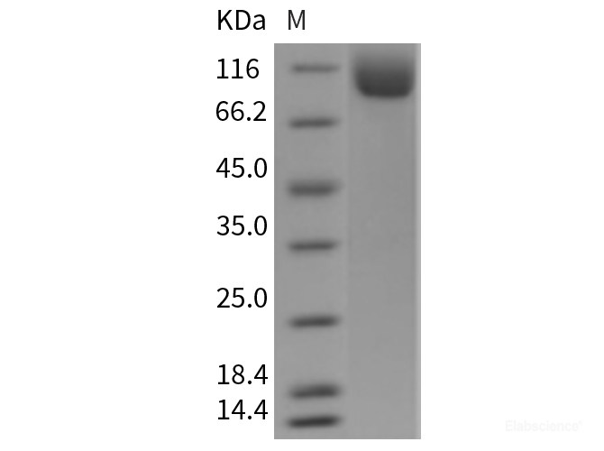 Recombinant Mouse NAALADL1 Protein (His tag)-Elabscience
