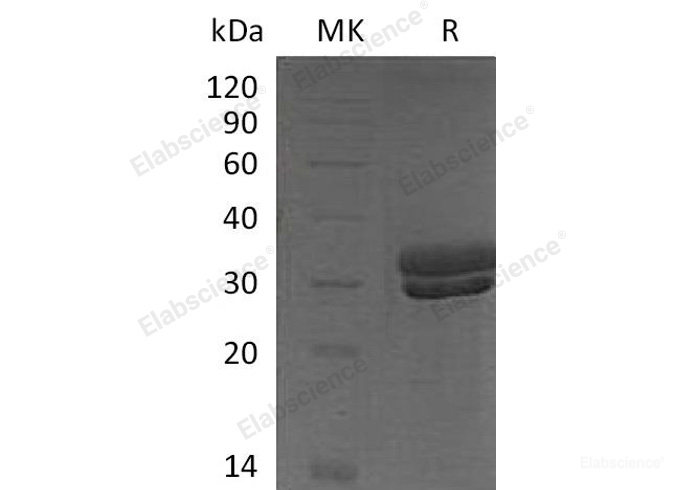 Recombinant Mouse  Kallikrein 7 Protein (His Tag)-Elabscience
