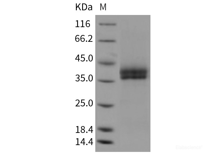 Recombinant Mouse KLK11 / Kallikrein-11 Protein (His tag)-Elabscience