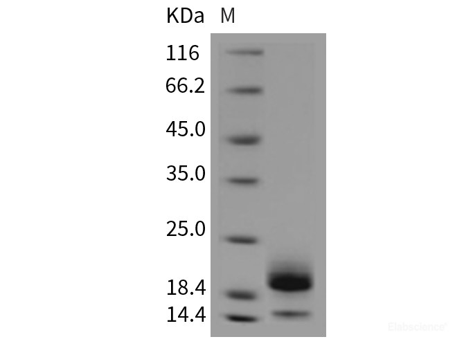 Recombinant Mouse CST6 Protein (His Tag)-Elabscience
