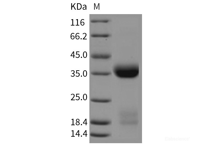 Recombinant Mouse KLK1 / Kallikrein 1 Protein (His tag)-Elabscience
