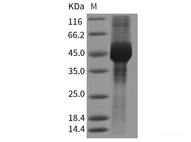 Recombinant Mouse GFRA3 / GFR-alpha-3 Protein (His tag)-Elabscience