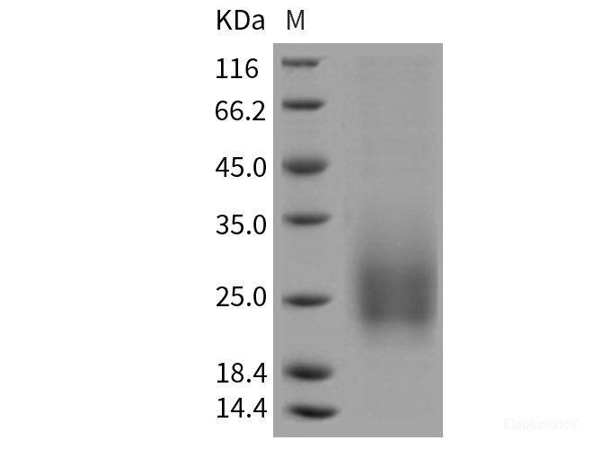 Recombinant Mouse TALLA-1 / TSPAN7 Protein (His tag)-Elabscience