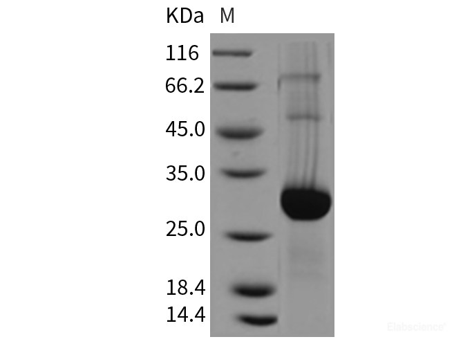 Recombinant Mouse GLIPR1 / RTVP1 Protein (His tag)-Elabscience