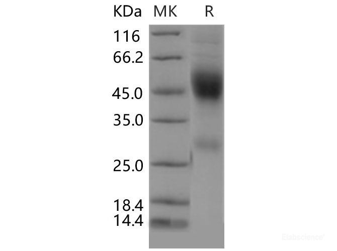 Recombinant Mouse Neurexophilin-1 / NXPH1 Protein (His tag)-Elabscience