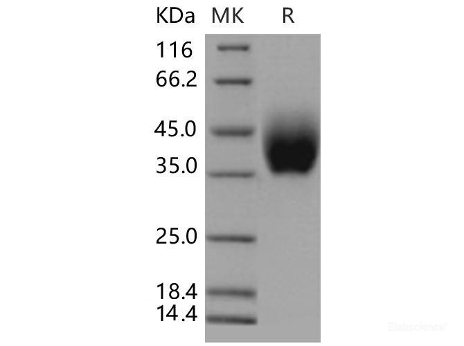 Recombinant Mouse IL10RB / IL10R2 Protein (His tag)-Elabscience