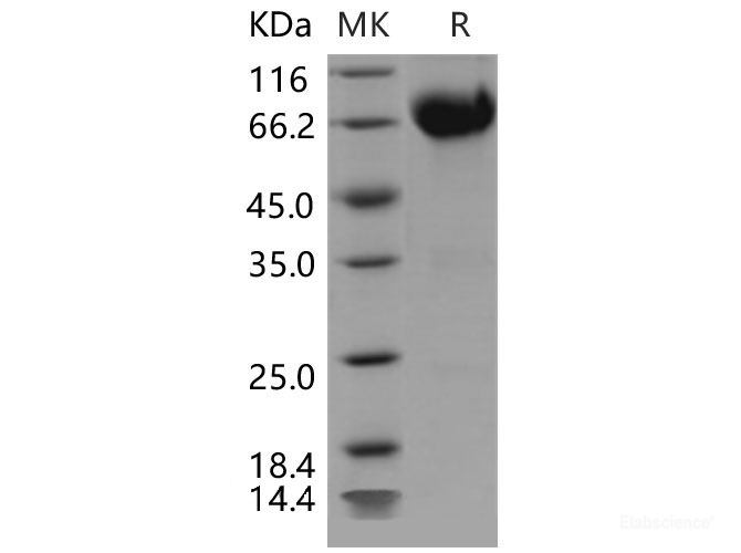 Recombinant Mouse IL10RB / IL10R2 Protein (Fc tag)-Elabscience