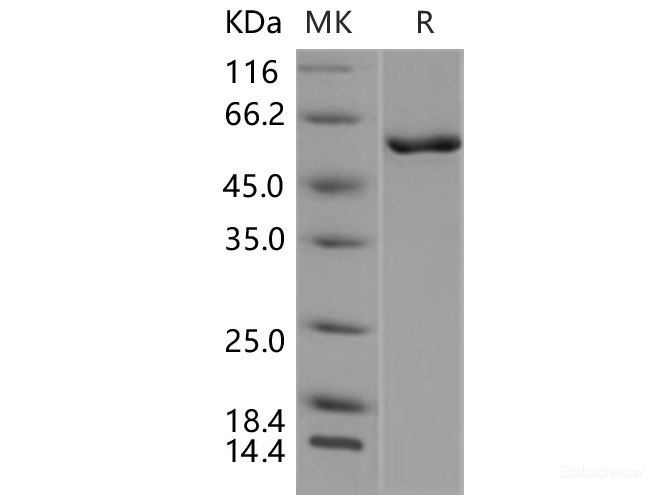 Recombinant Mouse CAMK4 / CaMKIV Protein-Elabscience