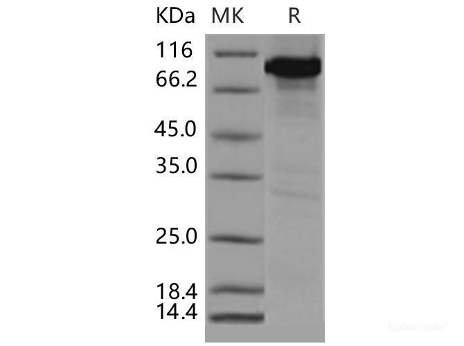 Recombinant Mouse CAMK4 / CaMKIV Protein (His & GST tag)-Elabscience