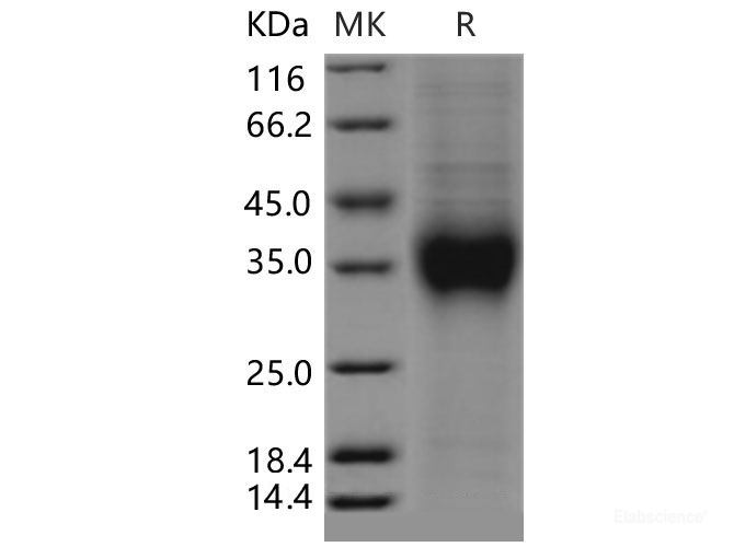 Recombinant Mouse NKG2A / NKG2 / CD159A / KLRC1 Protein (His tag)-Elabscience