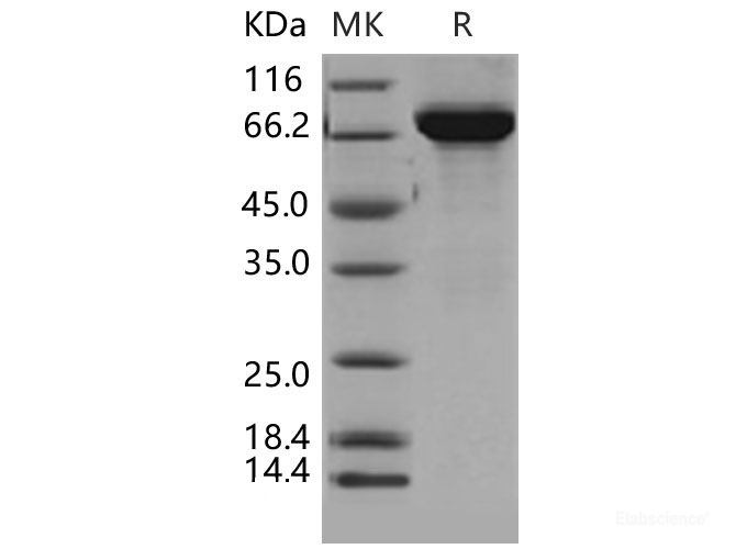 Recombinant Mouse THOP1 Protein (His tag)-Elabscience