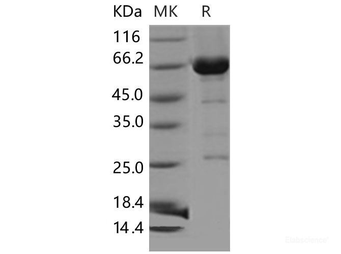 Recombinant Mouse CDC37 / CDC37A Protein (His & GST tag)-Elabscience