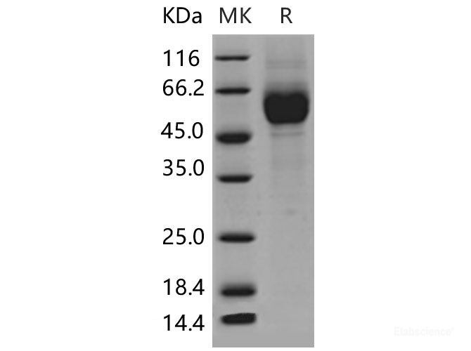 Recombinant Mouse IL1R1 / CD121a Protein (His tag)-Elabscience