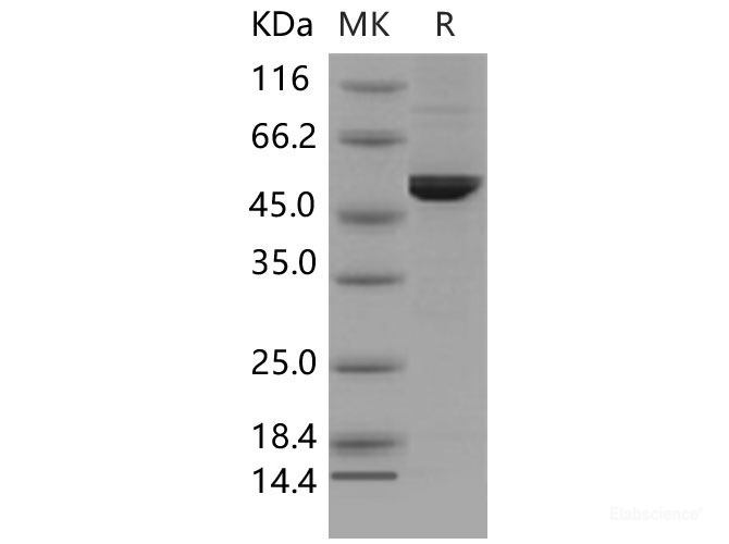 Recombinant Mouse DOPA Decarboxylase / DDC Protein (His tag)-Elabscience