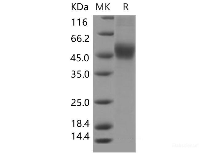 Recombinant Mouse CD122 / IL2RB / IL2 Receptor beta Protein (His tag)-Elabscience