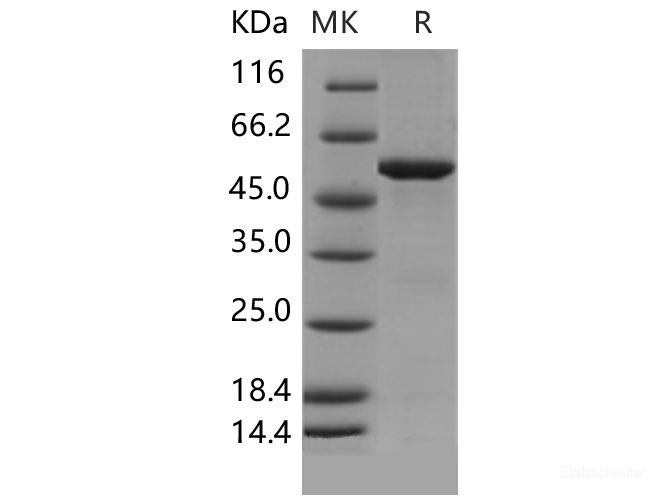 Recombinant Mouse SPG21 / ACP33 Protein (His & GST tag)-Elabscience