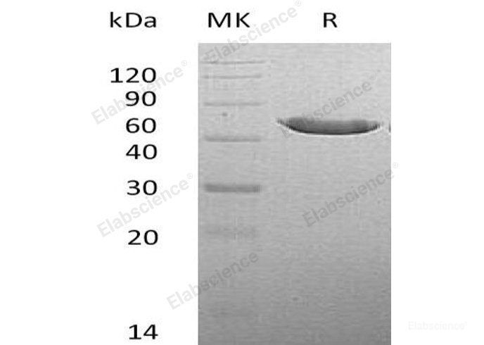 Recombinant Mouse  Carboxypeptidase A2 Protein (His Tag)-Elabscience