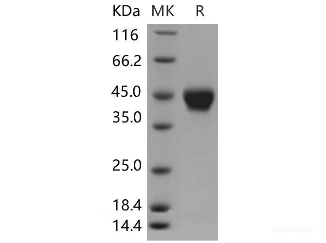 Recombinant Mouse STHM / ST6GALNAC2 Protein (His tag)-Elabscience