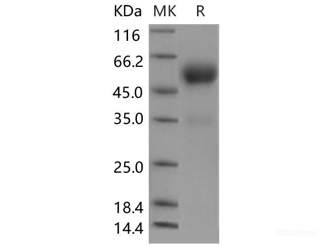Recombinant Mouse Frizzled-5 / FZD5 Protein (Fc tag)-Elabscience