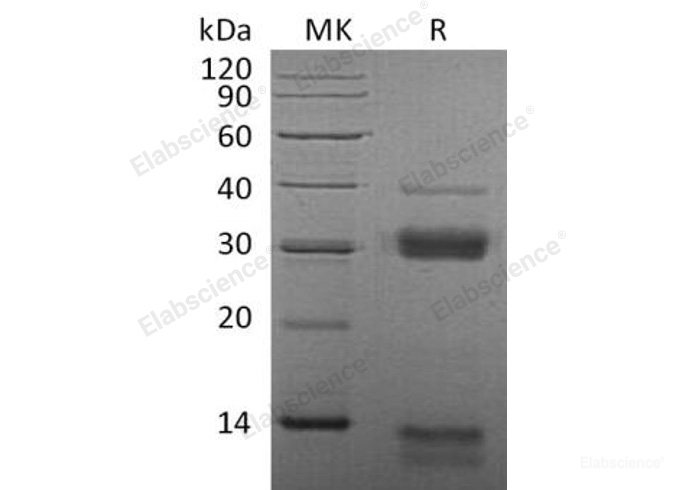 Recombinant Mouse  Cathepsin S Protein (His Tag)-Elabscience