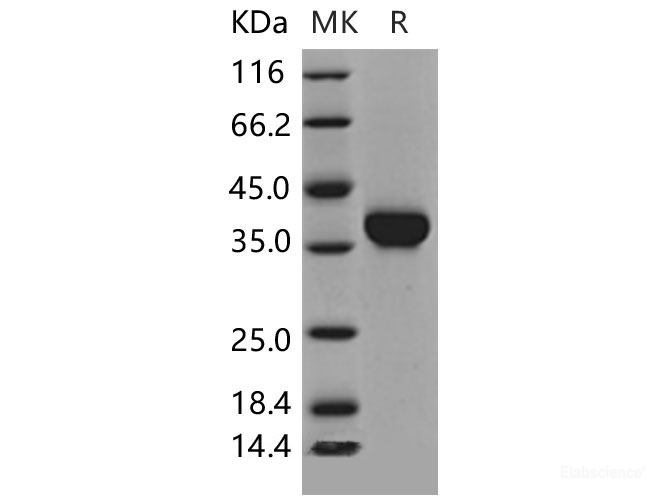 Recombinant Mouse Carbonic Anhydrase X / Car10 Protein (His tag)-Elabscience