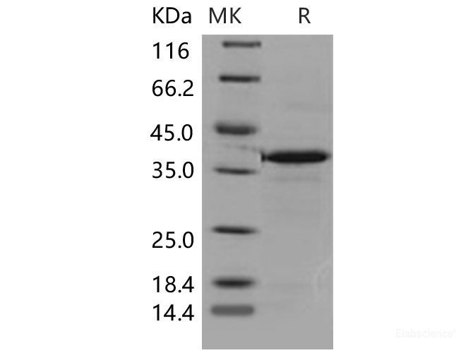 Recombinant Mouse Carbonic Anhydrase VIII / Car8 Protein (His tag)-Elabscience