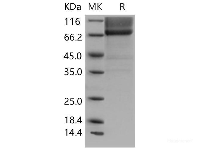 Recombinant Mouse Biglycan / PG-S1 / BGN Protein (Fc tag)-Elabscience