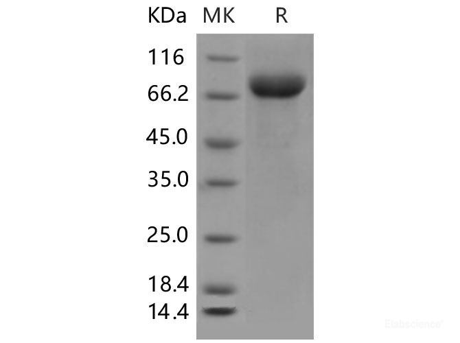 Recombinant Mouse LILRB3 / LIR3 / ILT5 / CD85a Protein (His tag)-Elabscience