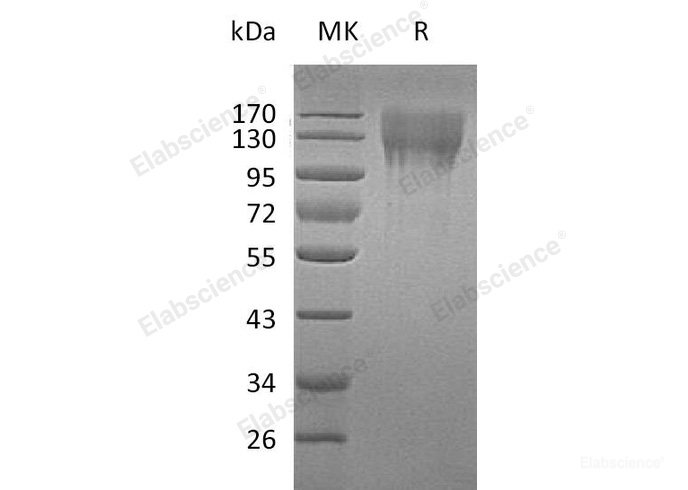 Recombinant Mouse  CD96 Protein (His Tag)-Elabscience