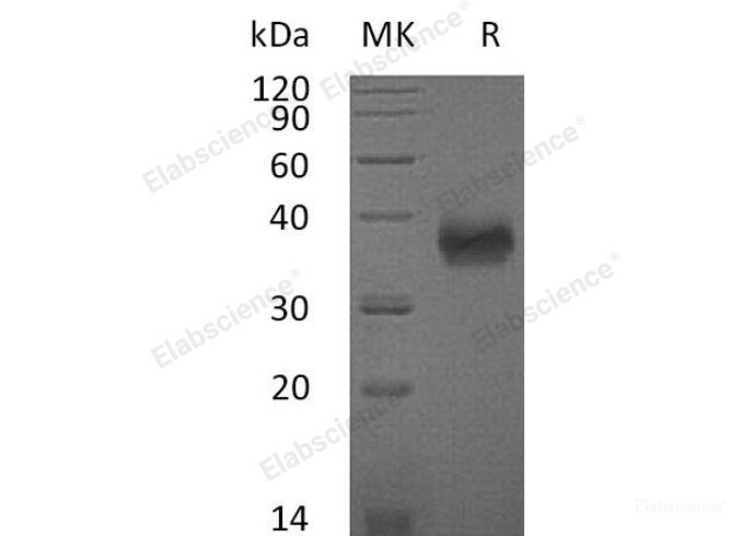 Recombinant Mouse  CD84 Protein (His Tag)-Elabscience