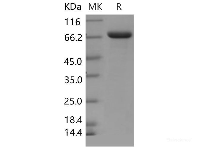 Recombinant Mouse Lactotransferrin / LTF Protein (His tag)-Elabscience