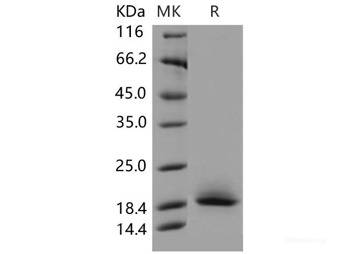 Recombinant Mouse CD59a / Protectin / MAC-IP Protein (His tag)-Elabscience