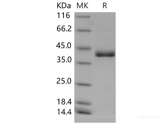 Recombinant Mouse CD59a / Protectin / MAC-IP Protein (Fc tag)-Elabscience