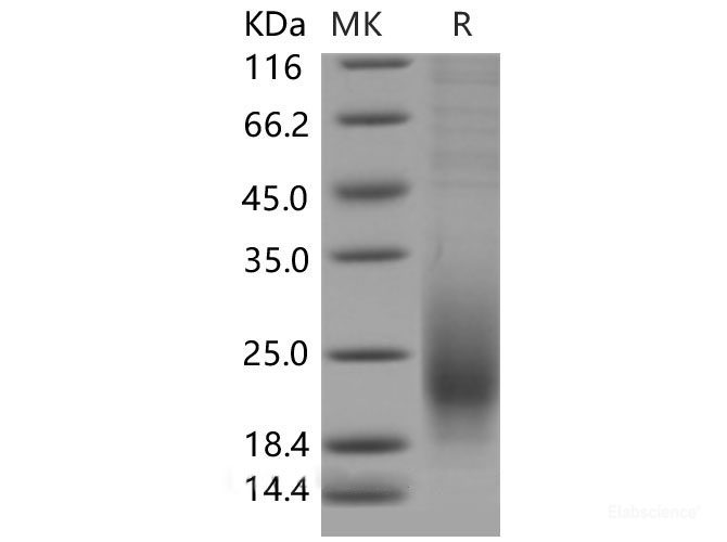 Recombinant Mouse CD53 Protein (aa 107-181, His tag)-Elabscience