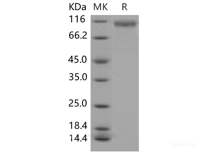 Recombinant Mouse HER2 / ErbB2 / CD340 Protein (His tag)-Elabscience