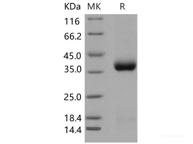 Recombinant Mouse CLEC10A / MGL1 / CD301 Protein (His tag)-Elabscience