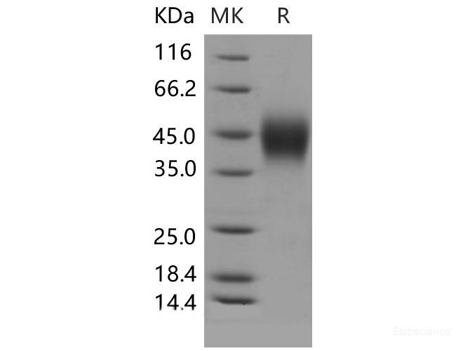 Recombinant Mouse IFNGR1 / CD119 Protein (His tag)-Elabscience