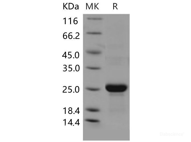 Recombinant Mouse CLEC3B / Tetranectin Protein (His tag)-Elabscience