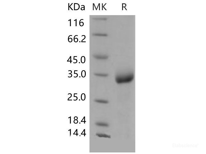 Recombinant Mouse CHODL / Chondrolectin Protein (His tag)-Elabscience