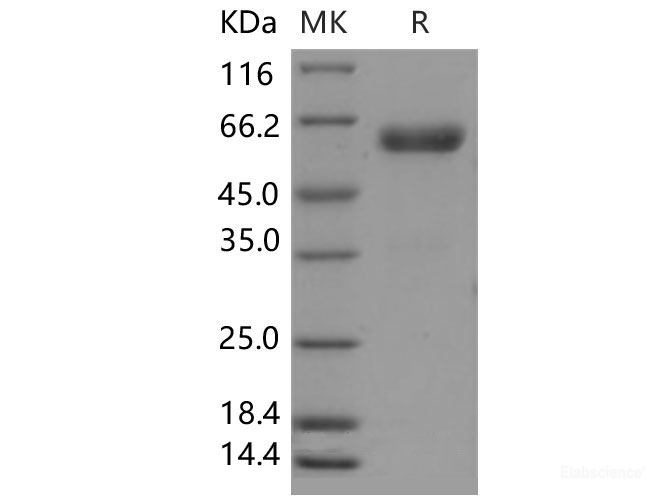 Recombinant Mouse CHODL / Chondrolectin Protein (Fc tag)-Elabscience