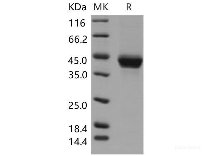 Recombinant Mouse CD23 / FCER2 Protein (His tag)-Elabscience