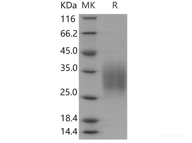 Recombinant Mouse  CD83 Protein (His Tag)-Elabscience