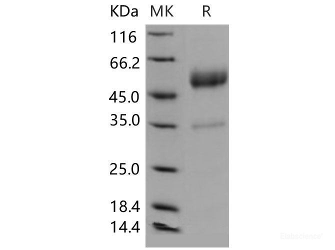 Recombinant Mouse CD83 / HB15 Protein (Fc tag)-Elabscience