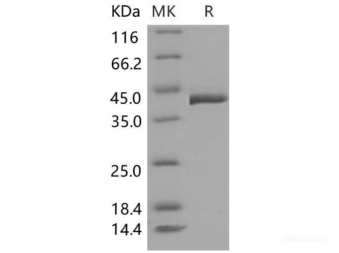 Recombinant Mouse TCN2 / Transcobalamin-II Protein (His tag)-Elabscience